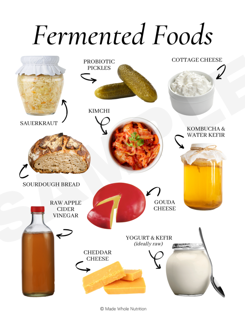 fermented foods for gut-brain axis and anxiety relief - kimchi, yogurt, sauerkraut